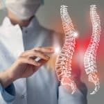 Quand faire une arthrodèse lombaire ?